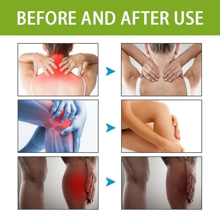 BeeTherapy™ #1 Bee Venom Pain Relief Cream | Buy 1 Get 2 Free🔥