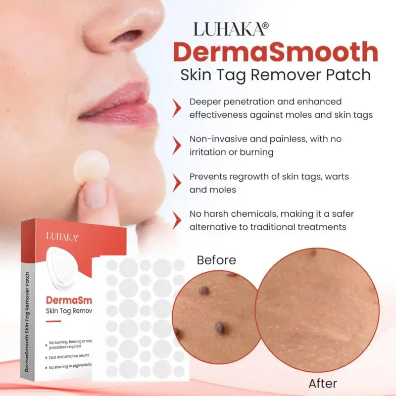 Derma Smooth Skin Tag Removal Patch 🌟